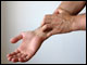 Allergien Startseite